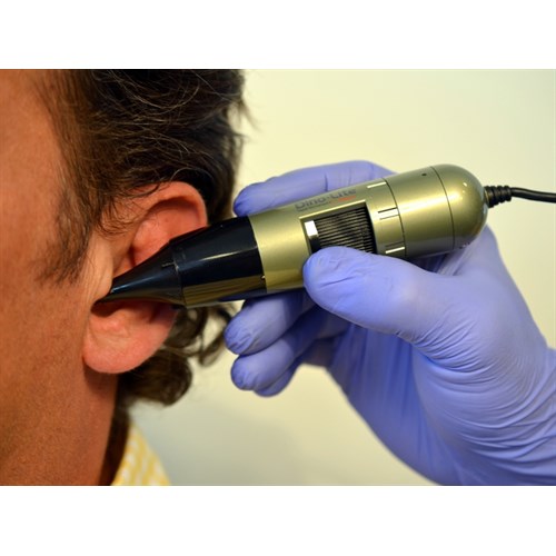 Dino-Lite EarScope Pro 1,3Mpx, 55-90x