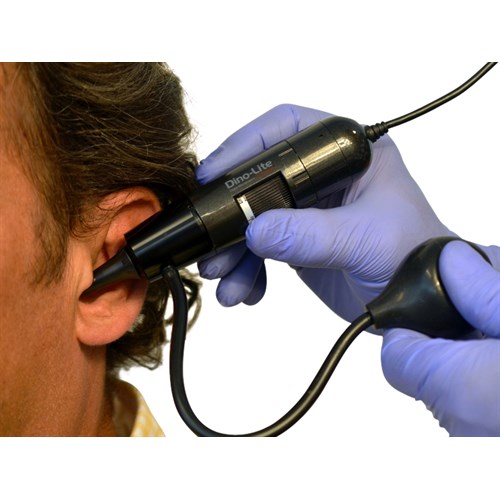 Dino-Lite EarScope Pneumatic 1,3Mpx, 55-90x