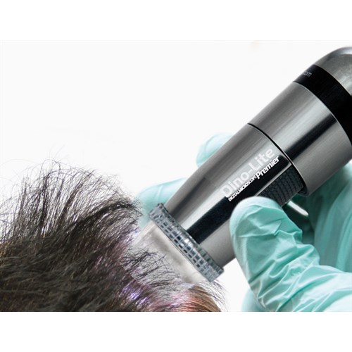 Dino-Lite TrichoScope 5Mpx, 10-70 & 200x